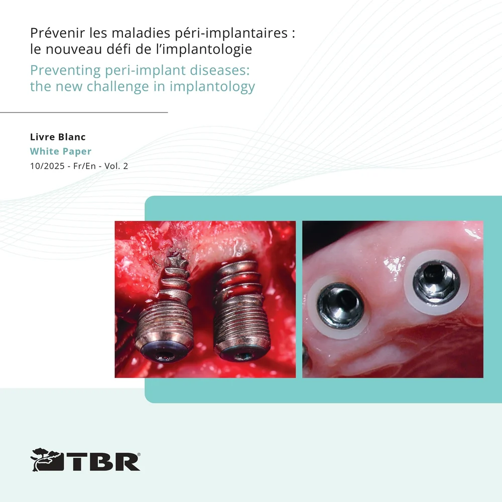 White Paper Vol.2 — Preventing peri-implant diseases
