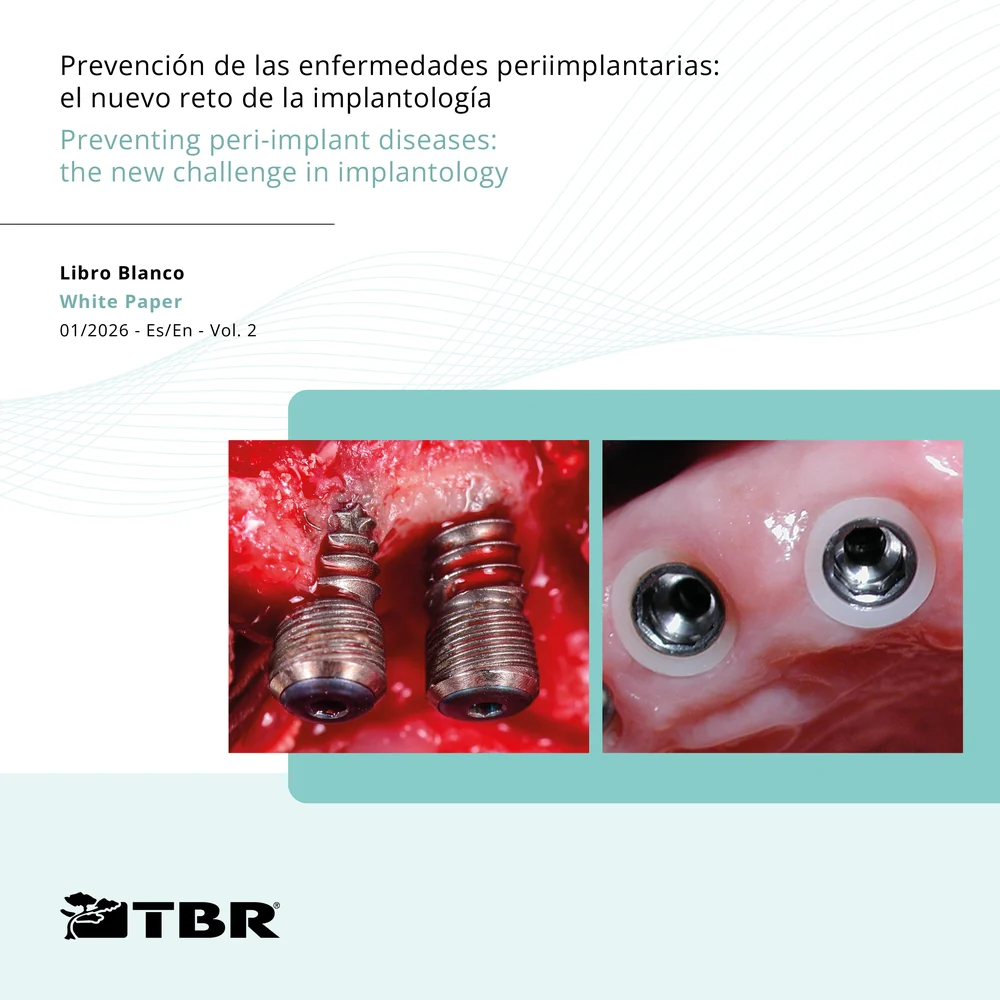 Libro Blanco Vol.2 — Prevención de las enfermedades periimplantarias