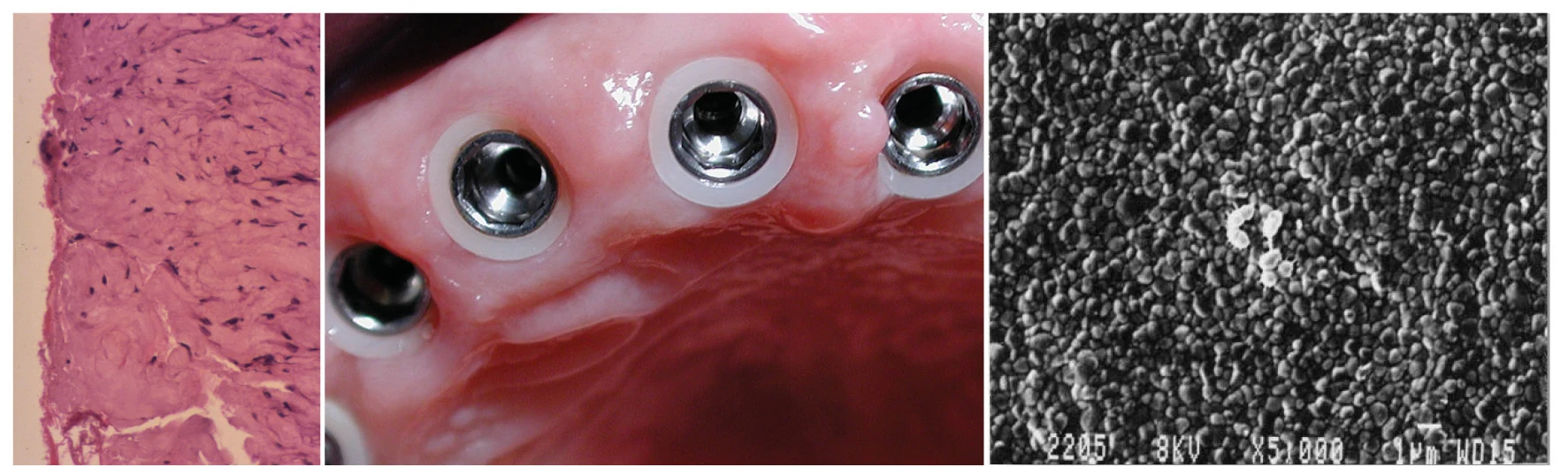 Z1 zirconia collar — product view