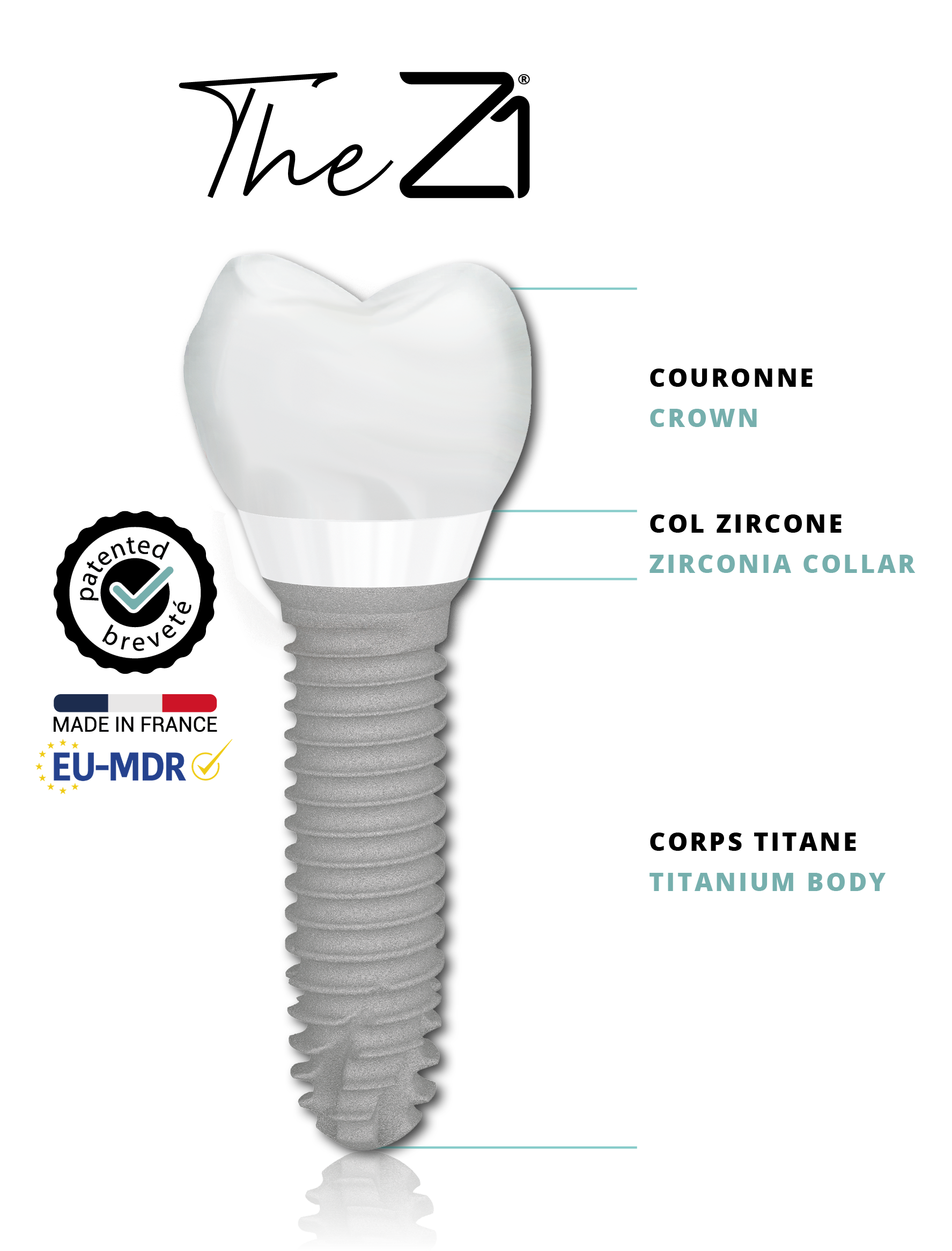 Z1 implant — product visual